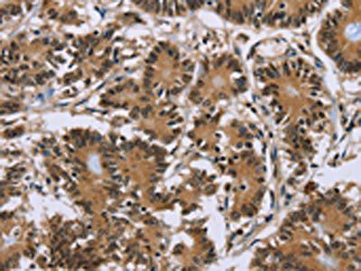 P2RY1 Antibody