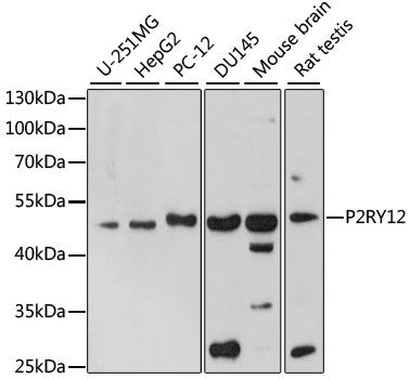 P2RY12 antibody