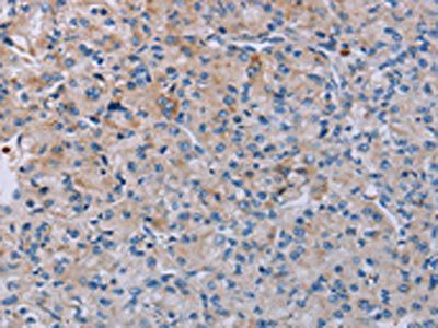 P2RY2 antibody