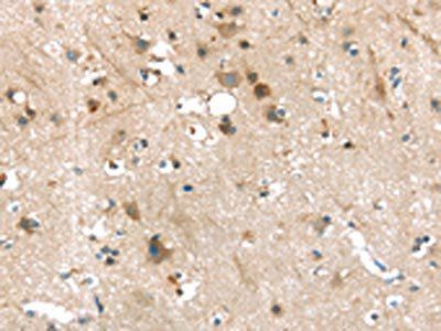 P2RY2 Antibody