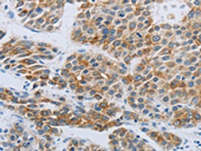 P2RY4 Antibody