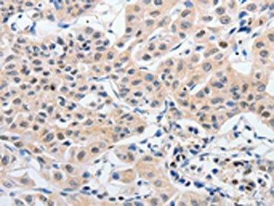P2RY6 Antibody
