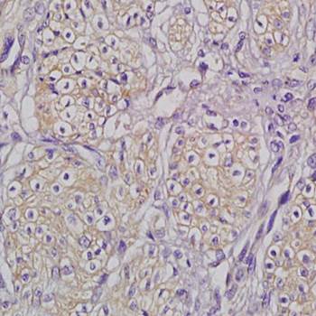 P2Y2 Rabbit Polyclonal Antibody