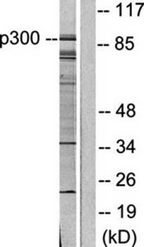 p300/CBP Antibody