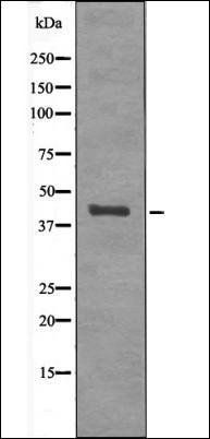 p38-gamma/delta (Phospho-Tyr18gamma/delta82) antibody