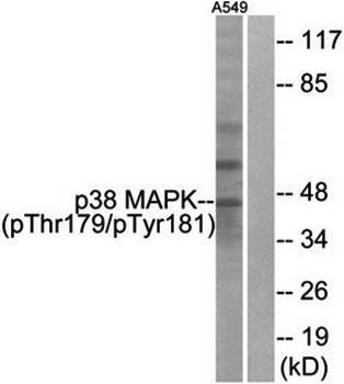 p38 MAPK (Phospho-Thr180+Tyr182) Antibody