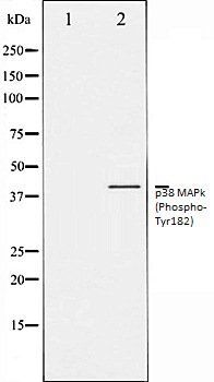 p38 MAPk (Phospho-Tyr182) antibody