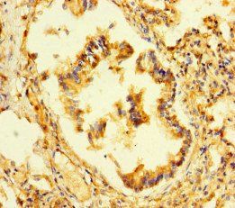P3H2 Antibody