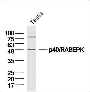 p40 antibody