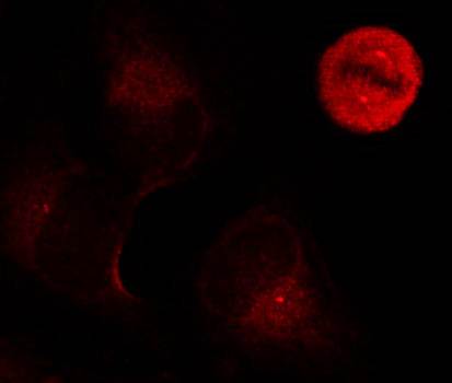 p44/42 MAP Kinase (Phospho-Tyr204) Antibody