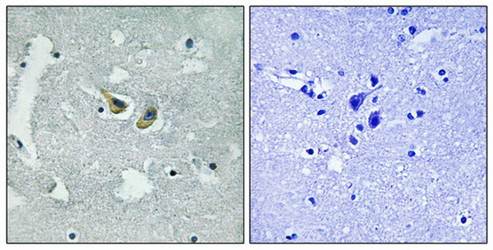 p47 phox (Phospho-Ser345) Antibody