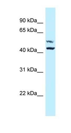 P4HA1 antibody