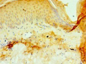 P4HA3 Antibody