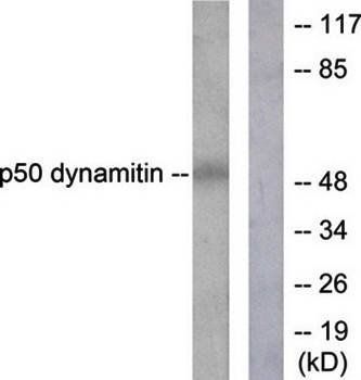 p50 Dynamitin antibody