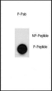 p53 (phospho-Ser315) antibody