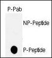 p53 (phospho-Thr18) antibody