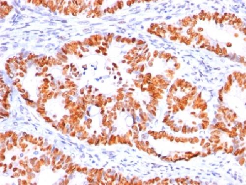 TP53 Antibody