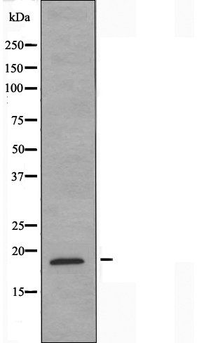 p53 I11 antibody