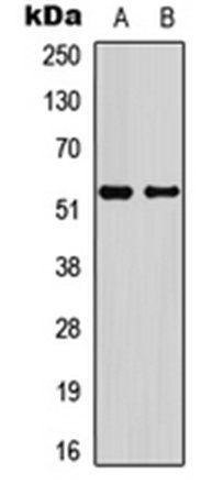 p53 (Phospho-S6) antibody