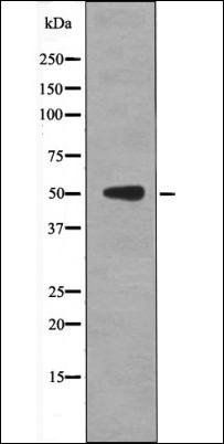 p53 (Phospho-Thr55) antibody