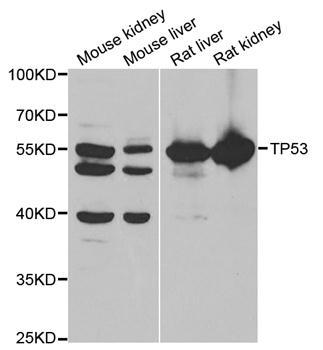 p53 antibody