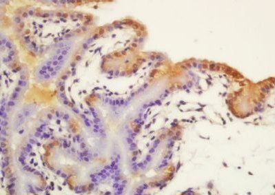 PERP/p53 apoptosis effector related to PMP22 Rabbit Polyclonal Antibody