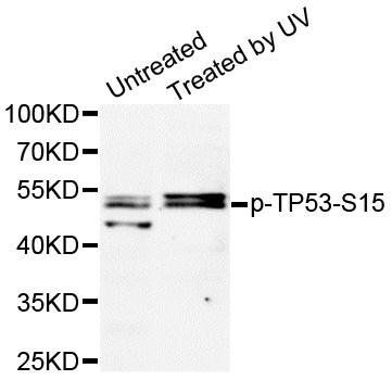 p53 (phospho-S15) antibody
