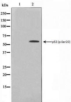 p53 (phospho-Ser20) antibody