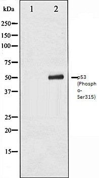 p53 (Phospho-Ser315) antibody