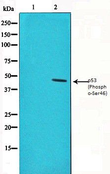 p53 (Phospho-Ser46) antibody