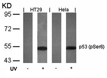 p53 (Phospho-Ser6) Antibody