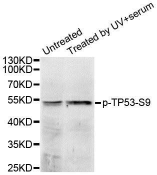 p53 (phospho-S9) antibody