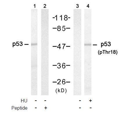 p53 (Phospho-Thr18) Antibody