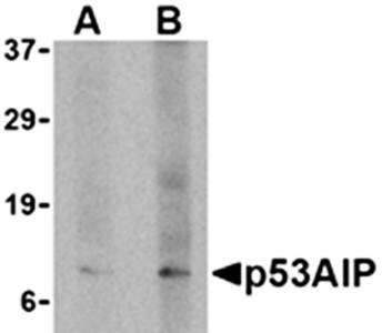 p53AIP1 Antibody