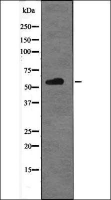 p56 Dok-2 (Phospho-Tyr345) antibody