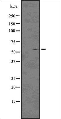 p57 Kip2 (Phospho-Thr310) antibody