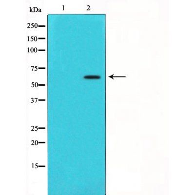 P62/SQSTM1 antibody