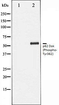 p62 Dok (Phospho-Tyr362) antibody