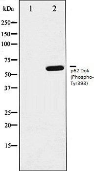 p62 Dok (Phospho-Tyr398) antibody