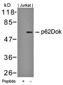 p62Dok (Ab-362) Antibody