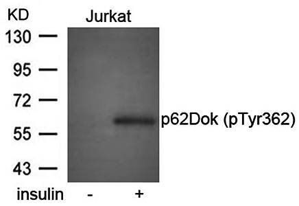 p62Dok (phospho-Tyr362) Antibody