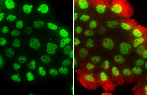 p63 antibody [N2C1], Internal