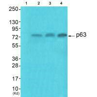 p63 antibody