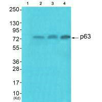 TP63 Antibody