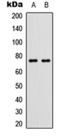 p63 (phospho-S455) antibody