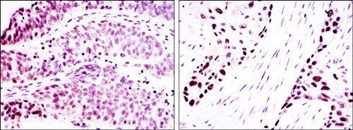p63a Antibody