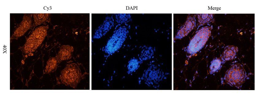 p63 antibody