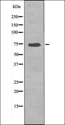 p70 S6 Kinase (Phospho-Ser427) antibody