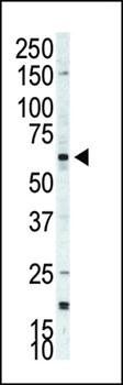 p70 S6Kbeta antibody