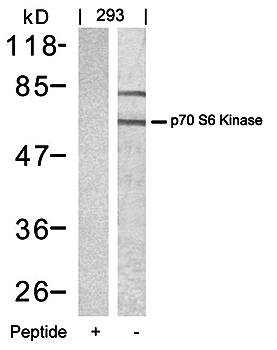 p70 S6 Kinase (Ab-389) Antibody